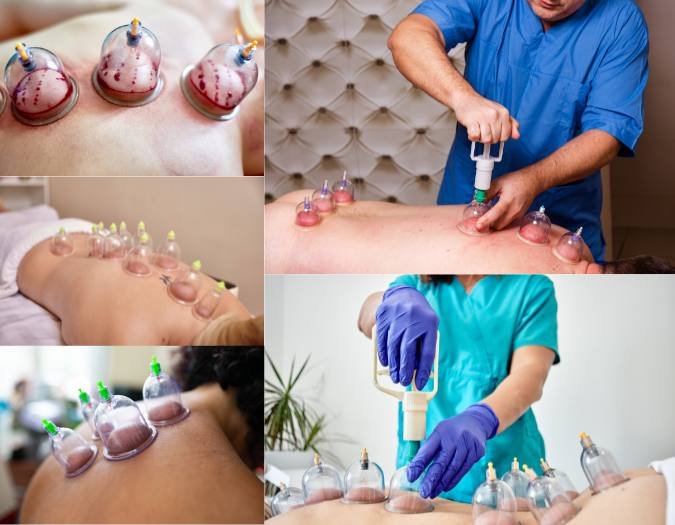 Hijama ventouses bien être séance à domicile Rabat Salé Témara