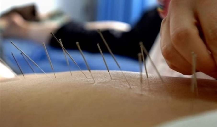Séance d’acupuncture thérapeutique à domicile au Maroc