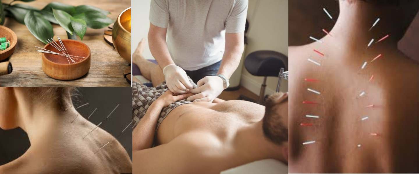 Acupuncture et médecine chinoise à domicile au Maroc pour la douleur, la récupération et le bien-être