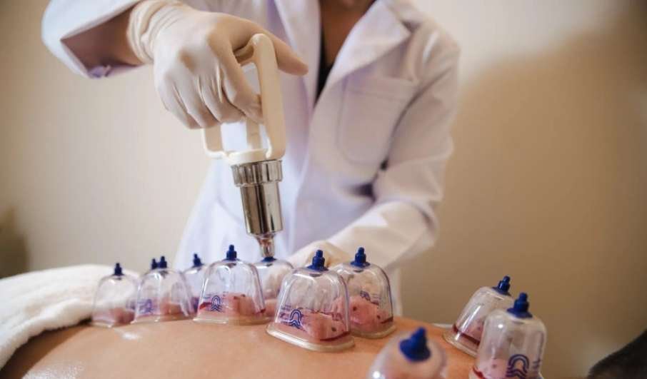 Hijama sèche à domicile avec ventouses