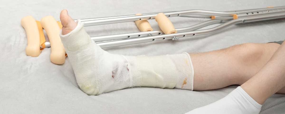 Quand reprendre l'appui après une fracture de cheville avec la kiné