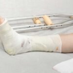 Quand reprendre l'appui après une fracture de cheville avec la kiné