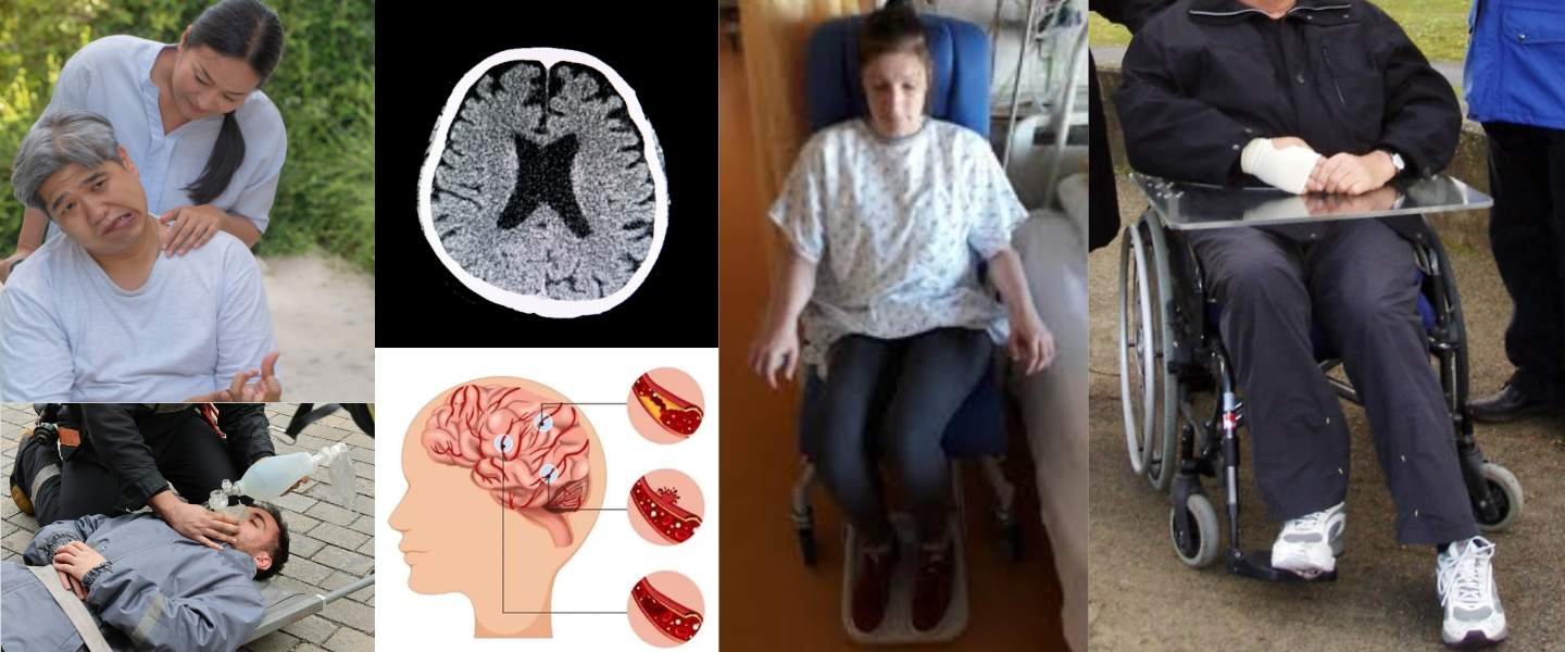 Accident vasculaire cérébral et rééducation après AVC à domicile