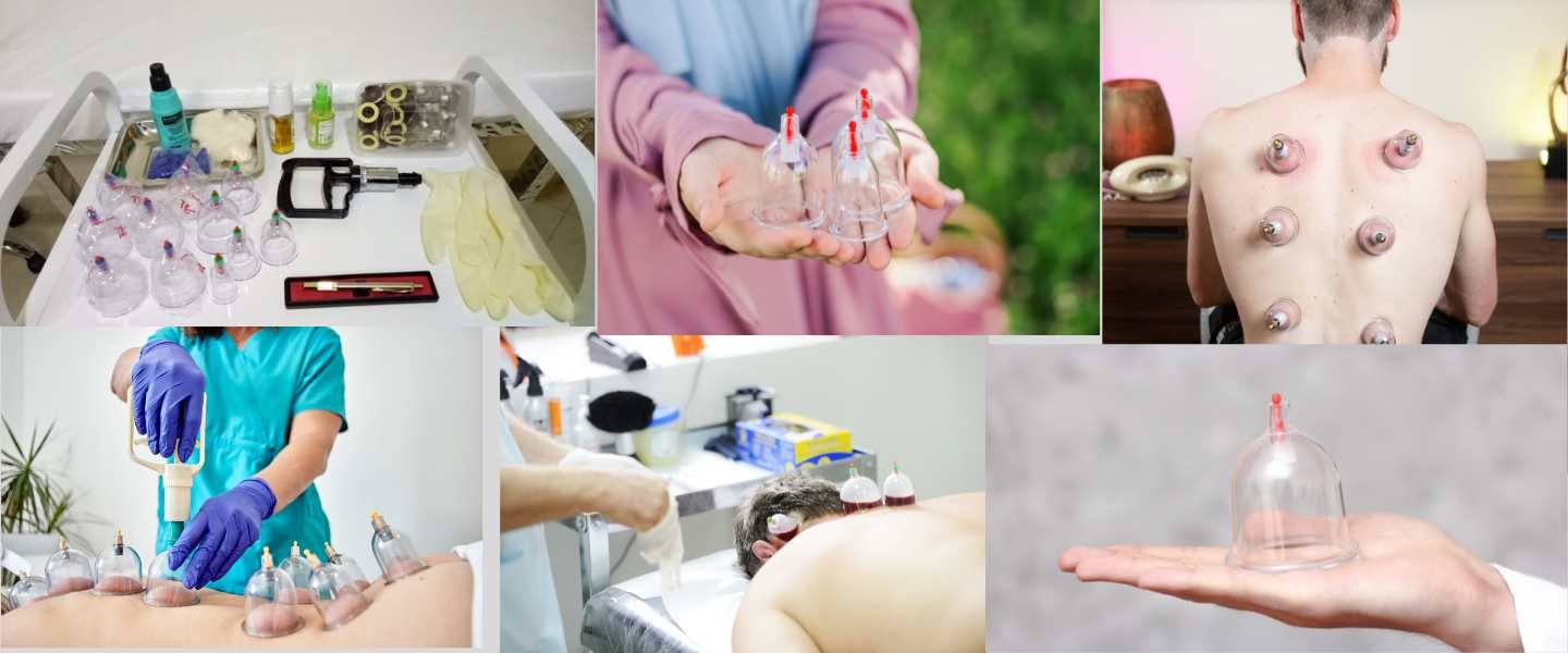 Séance de hijama sèche et humide à domicile avec matériel de hijama au Maroc